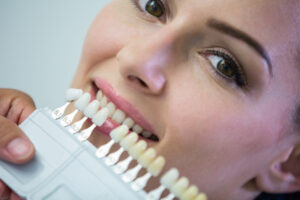 O que é Lente de Contato Dental?